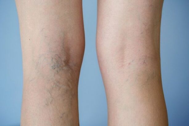 Different veins