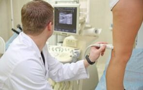 Methods for treating varicose veins of the feet in women